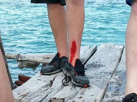 Name:  Cut leg.jpg
Views: 708
Size:  39.7 KB