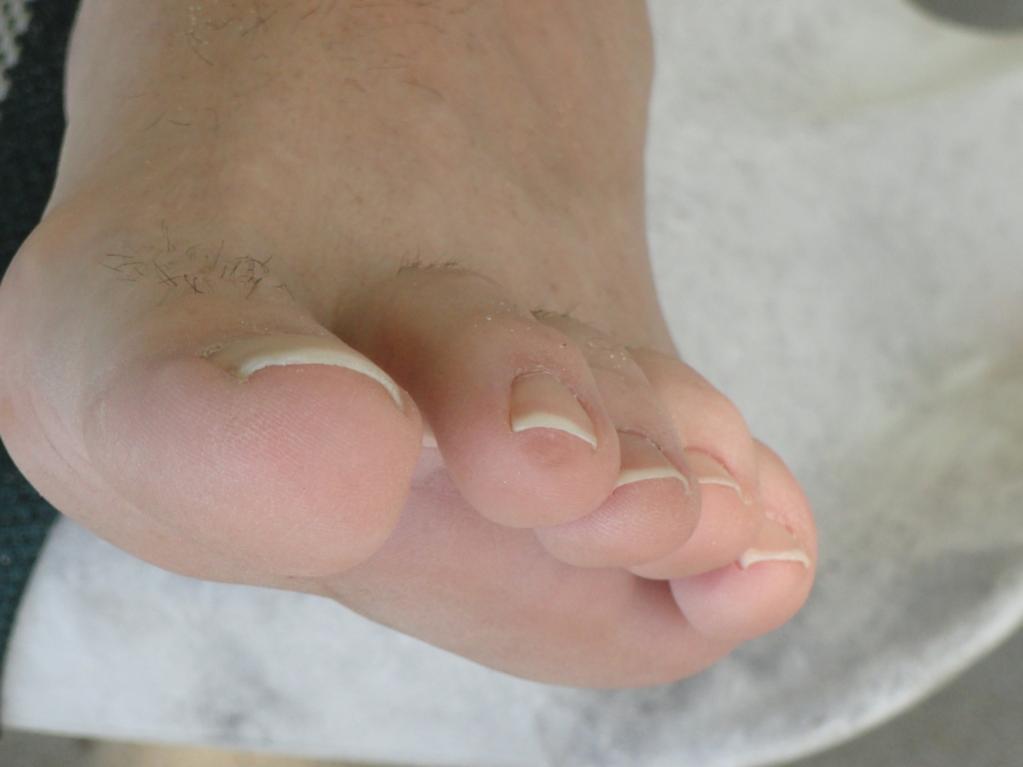 Name:  jeffs foot 1 12-4.jpg
Views: 284
Size:  40.2 KB